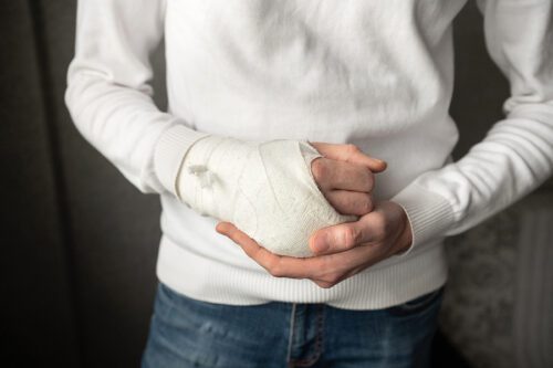 The broken hand of a man in a cast