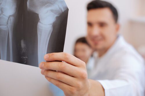 Male doctor examining an x-ray 