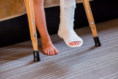 Closeup of a child's legs and feet with one leg in a cast and holding crutches. 