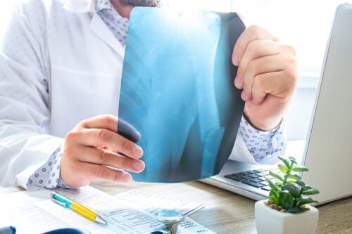 What If Your Medical Bills Exceed Insurance Limits?